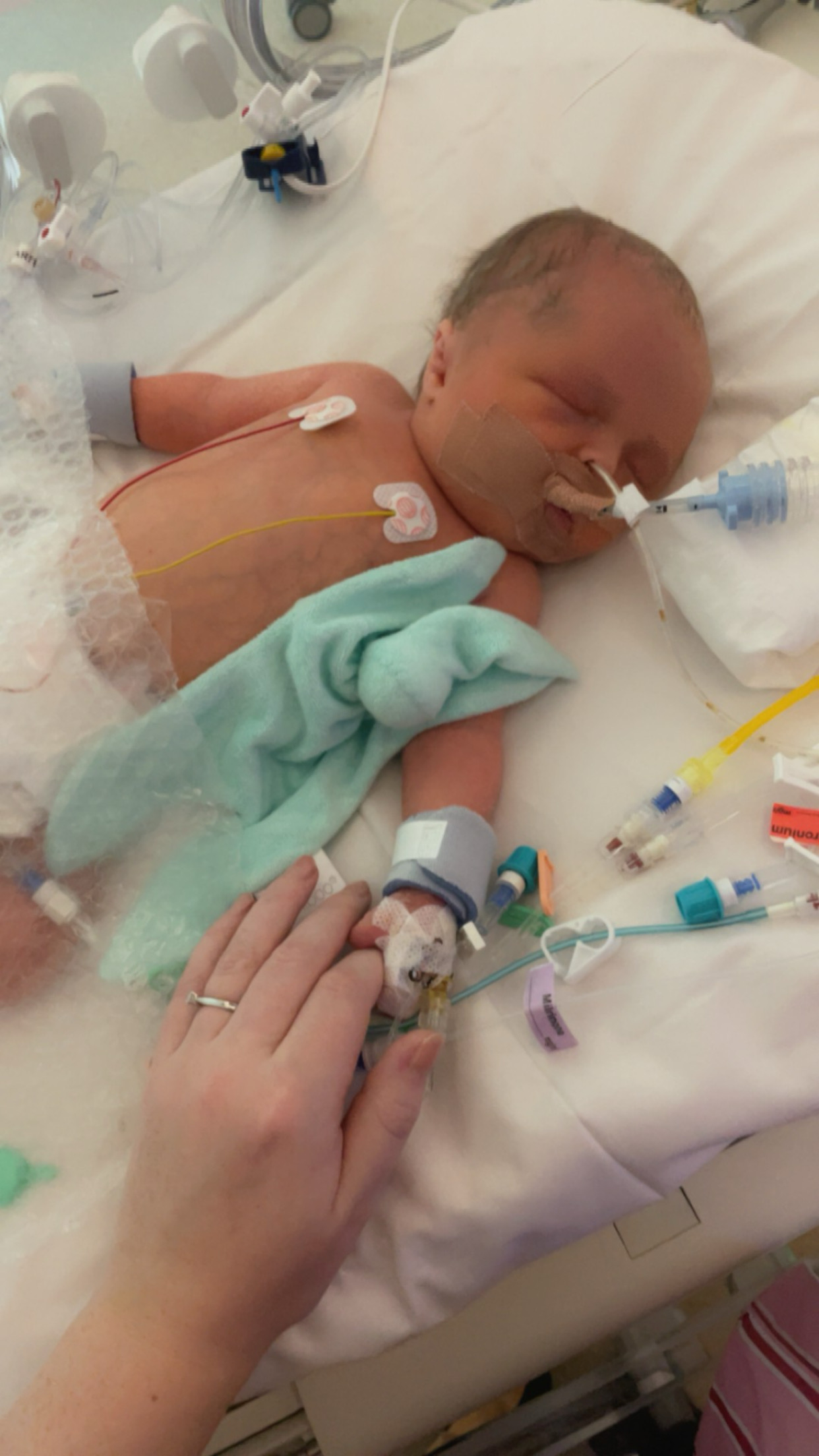 Aidan's chances of survival were described as uncertain
