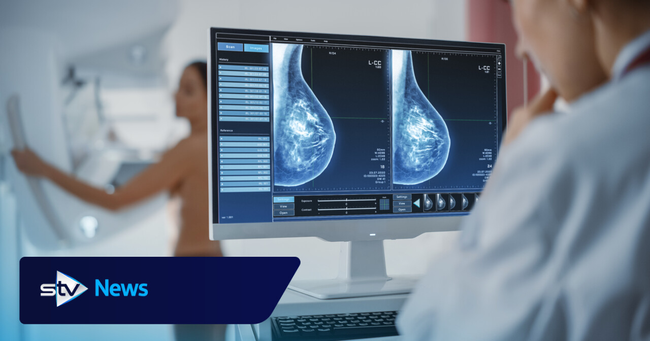 Fraudulent NHS breast screening email urges women to send images and photos