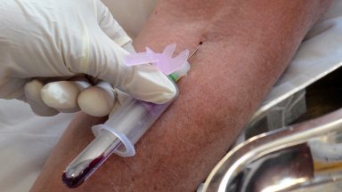 Six-hour sepsis test identified infection days before conventional methods