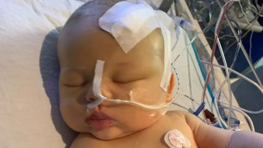 Mother tells how nail infection led to diagnosis of baby son’s brain tumour