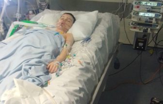Schoolboy from Paisley lost four fingers and part of palm after firework exploded in hand